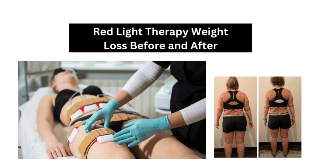 Red Light Therapy Weight Loss Before and After